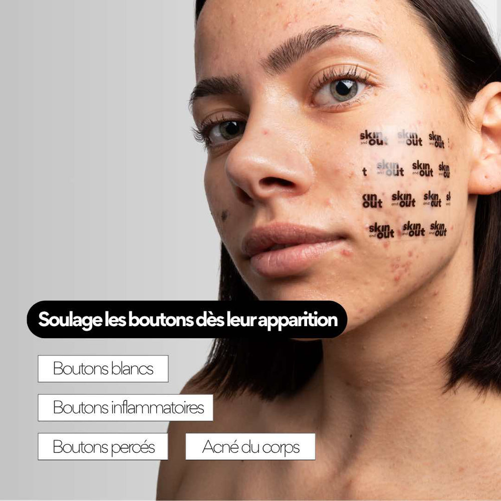 CLEAR OUT – Patchs XL boutons hydrocolloïdes