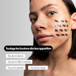 CLEAR OUT – Patchs XL boutons hydrocolloïdes