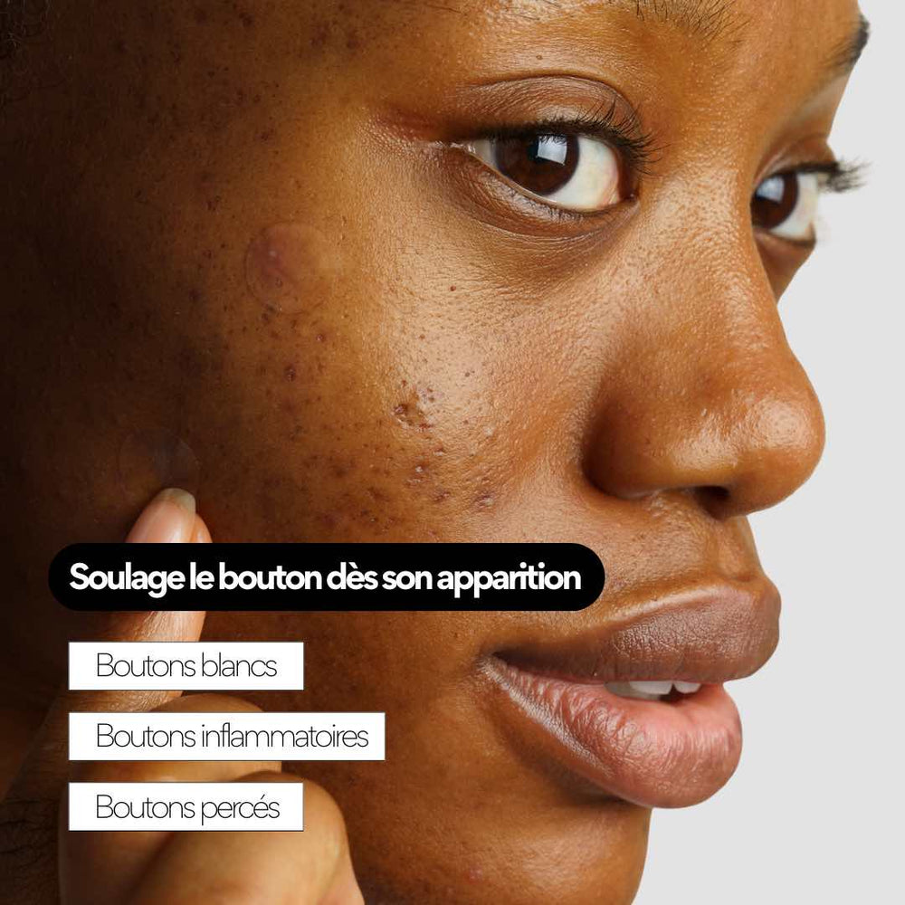 CLEAR OUT – Patchs boutons hydrocolloïdes