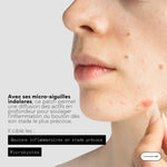 CLEAR OUT – Patchs boutons sous-cutanés micro-aiguilles